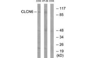 Western blot analysis of extracts from COS7/HT-29 cells, using CLCN6 Antibody. (CLCN6 Antikörper  (AA 611-660))