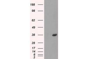 Image no. 9 for anti-Fc gamma RII (CD32) antibody (ABIN1497254) (Fc gamma RII (CD32) Antikörper)