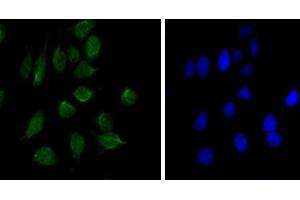Immunofluorescence analysis of Hela cells using CHD3 mouse mAb (green). (CHD3 Antikörper)