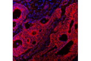 IF analysis of VAPA using anti-VAPA antibody (ABIN7603249). (VAPA Antikörper  (N-Term))