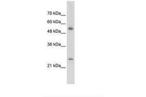 Image no. 1 for anti-Adenylate Kinase 4 (AK4) (AA 126-175) antibody (ABIN203378)