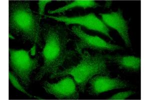 Immunofluorescence (IF) image for anti-Cbp/p300-Interacting Transactivator, with Glu/Asp-Rich Carboxy-terminal Domain, 4 (CITED4) (AA 131-184) antibody (ABIN531142)