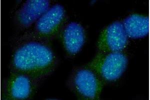 anti-Poliovirus Receptor-Related 2 (Herpesvirus Entry Mediator B) (PVRL2) (AA 32-348) antibody