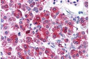 Human Pancreas (formalin-fixed, paraffin-embedded) stained with TLR3 antibody ABIN214574 at 5 ug/ml followed by biotinylated goat anti-rabbit IgG secondary antibody ABIN481713, alkaline phosphatase-streptavidin and chromogen. (TLR3 Antikörper  (N-Term))