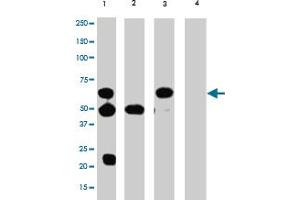 Immunoprecipitation (IP) / Western Blot (WB) Analysis of TERF2 in HL-60 cells : (Lane 1) IP with mouse TERF2 monoclonal antibody, clone 4A794. (TRF2 Antikörper)