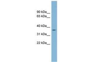 Image no. 1 for anti-Transmembrane (C-terminal) Protease, serine 12 (TMPRSS12) (AA 215-264) antibody (ABIN6742044) (TMPRSS12 Antikörper  (AA 215-264))