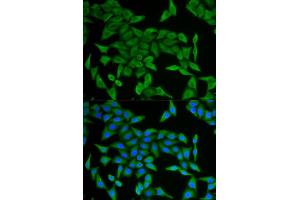 Immunofluorescence (IF) image for anti-Cellular Retinoic Acid Binding Protein 2 (CRABP2) antibody (ABIN1882301) (CRABP2 Antikörper)