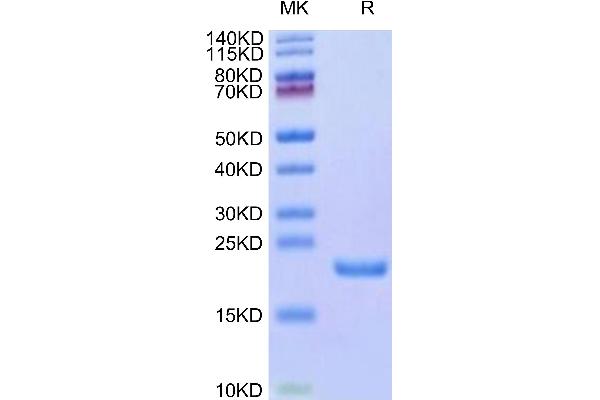 AGR2 Protein (AA 21-175) (His tag)