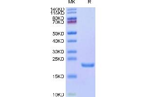 Mouse AGR-2 on Tris-Bis PAGE under reduced condition. (AGR2 Protein (AA 21-175) (His tag))