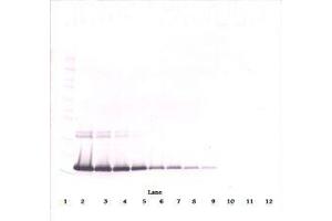 Image no. 1 for anti-Interleukin 2 (IL2) antibody (ABIN465129) (IL-2 Antikörper)