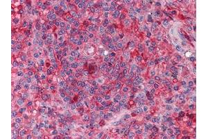 Immunohistochemical analysis of paraffin-embedded human Spleen tissues using anti-ARNTL mouse mAb (ARNTL Antikörper)