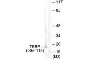 Western blot analysis of extracts from NIH-3T3 cells treated with EGF 200ng/ml 30', using TEBP (Phospho-Ser113) Antibody.