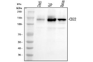 Western blot analysis of CD22 using anti-CD22 antibody (ABIN3043390).