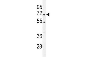 PRMT4 antibody western blot analysis in Jurkat lysate. (CARM1 Antikörper  (AA 346-377))