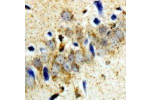 Immunohistochemical analysis of GCN2 staining in rat brain  formalin fixed paraffin embedded tissue section. (GCN2 Antikörper)