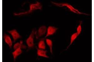 ABIN6266799 staining K562 by IF/ICC.