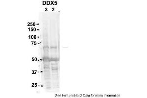 Sample Type: 2. (DDX5 Antikörper  (C-Term))