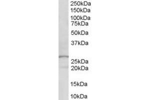 Western Blotting (WB) image for anti-Docking Protein 5 (DOK5) (AA 293-306) antibody (ABIN299685) (DOK5 Antikörper  (AA 293-306))