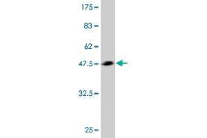 Western Blot detection against Immunogen (43. (TWIST2 Antikörper  (AA 1-160))