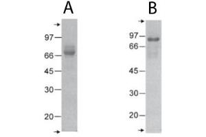 SDS-PAGE of recombinant rat COMP (T3+TC).