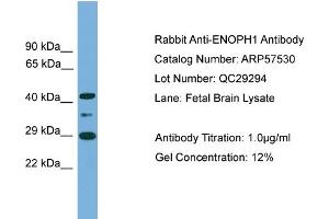 WB Suggested Anti-ENOPH1  Antibody Titration: 0. (MASA Antikörper  (Middle Region))