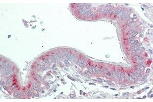 Immunohistochemistry (IHC) image for anti-phospholipase A2 Receptor 1, 180kDa (PLA2R1) (AA 1418-1487) antibody (ABIN7443389)