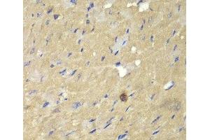 Immunohistochemistry of paraffin-embedded Mouse heart using AKR7A2 Polyclonal Antibody at dilution of 1:100 (40x lens). (AKR7A2 Antikörper)