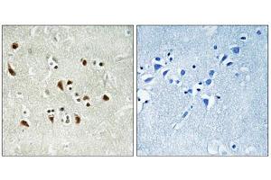 Immunohistochemistry analysis of paraffin-embedded human brain tissue using TUBGCP6 antibody. (GCP6 Antikörper  (Internal Region))