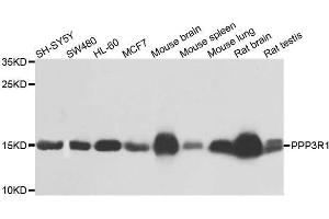 Western blot analysis of extracts of various cell lines, using PPP3R1 antibody. (PPP3R1 Antikörper  (AA 11-170))