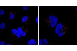 Immunofluorescent staining of HeLa cells incubated with MIB1 polyclonal antibody . (MIB1 Antikörper  (N-Term))