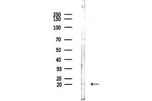 Western blot analysis of lysates from COLO205 cells(UV,30 min treatment), using CL2 Antibody at 1/1000 dilution. (CD164L2 Antikörper  (Internal Region))
