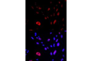 Immunofluorescence analysis of U2OS cells using HUS1 antibody (ABIN6131777, ABIN6142085, ABIN6142087 and ABIN6221056). (HUS1 Antikörper  (AA 1-280))