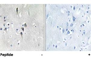 Immunohistochemical analysis of paraffin-embedded human brain tissue using CAMK2A/CAMK2D polyclonal antibody . (CAMK2A Antikörper)