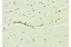 ABIN6276900 at 1/100 staining Mouse muscle tissue by IHC-P. (KEAP1 Antikörper  (N-Term))