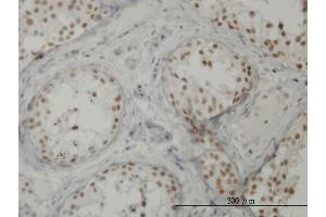 Immunoperoxidase of monoclonal antibody to CTNNBL1 on formalin-fixed paraffin-embedded human testis. (CTNNBL1 Antikörper  (AA 210-311))