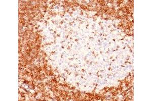 IHC testing of human tonsil stained with Bcl-2 antibody (8C8). (Bcl-2 Antikörper  (AA 41-54))