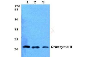 Western blot (WB) analysis of Granzyme H antibody  at 1/500 dilution. (GZMH Antikörper)