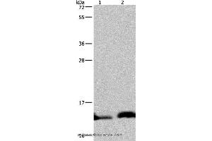 Western blot analysis of Human hepatocellular carcinoma and fetal brain tissue, using NDUFA5 Polyclonal Antibody at dilution of 1:400 (NDUFA5 Antikörper)