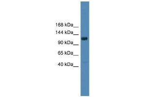WB Suggested Anti-DGKQ Antibody Titration: 0. (DGKQ Antikörper  (Middle Region))
