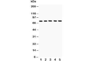 Western blot testing of 12 Lipoxygenase antibody and Lane 1:  A549;  2: MCF-7;  3: COLO320;  4: Jurkat;  5: HeLa;  Predicted size: 75KD;  Observed size: 75KD (12-Lipoxygenase Antikörper  (C-Term))