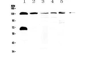 Western blot analysis of NEDD4-2 using anti-NEDD4-2 antibody . (NEDD4-2 Antikörper  (AA 703-975))