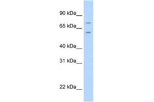 WB Suggested Anti-FOXK1 Antibody Titration:  2. (Foxk1 Antikörper  (C-Term))