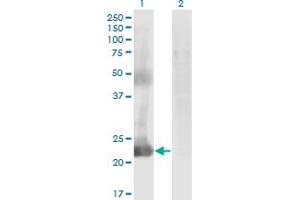 Western Blot analysis of CCDC115 expression in transfected 293T cell line by CCDC115 monoclonal antibody (M05), clone 4E9. (CCDC115 Antikörper  (AA 1-132))