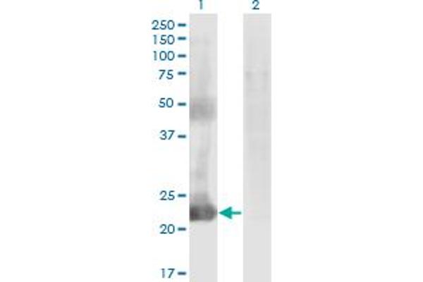CCDC115 Antikörper  (AA 1-132)