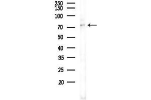 Western blot analysis of lysates from K562 cells(UV 30 min treatment), using Gab2 Antibody at 1/1000 dilution.