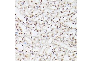 Immunohistochemistry of paraffin-embedded Mouse kidney using EP300 antibody (ABIN6127823, ABIN6140193, ABIN6140194 and ABIN6216844) at dilution of 1:100 (40x lens). (p300 Antikörper  (AA 1-270))