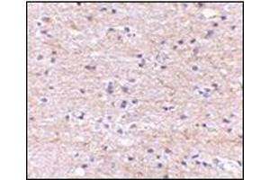 Immunohistochemistry of SATB2 in human brain with this product at 5 μg/ml. (SATB2 Antikörper  (N-Term))
