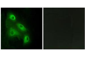 Immunofluorescence analysis of HeLa cells, using ES8L3 antibody. (EPS8-Like 3 Antikörper  (Internal Region))