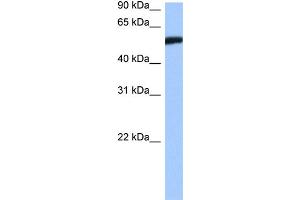 WB Suggested Anti-HMG20A Antibody   Titration: 1. (HMG20A Antikörper  (Middle Region))