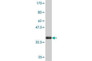 Western Blotting (WB) image for anti-Solute Carrier Family 27 (Fatty Acid Transporter), Member 5 (SLC27A5) (AA 90-175) antibody (ABIN564767)